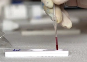 Rechaza Salud presencia de Hepatitis Aguda Grave en México