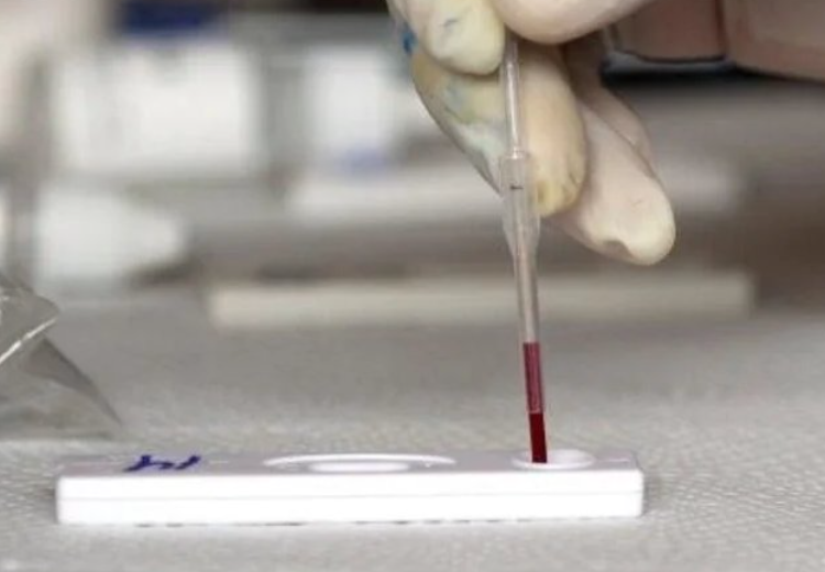 Rechaza Salud presencia de Hepatitis Aguda Grave en México