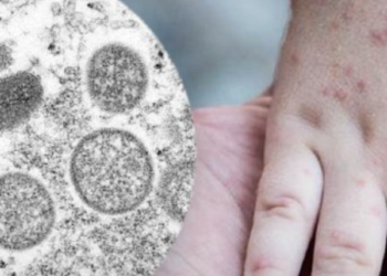 Detienen al cirujano de las novias de La Unión Tepito