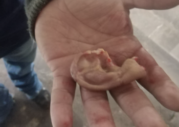 Sujeto arranca la oreja a un pasajero luego de una riña en Metro Xola