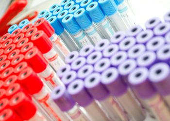 ISSEMYM exige mayor calidad en la contratación de laboratorios