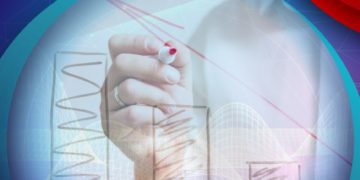 Operación de cajeros suma inteligencia y eficiencia con Auriga