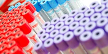 ISSEMYM enfrenta revisión tras admisión de inconformidad por licitación de laboratorio